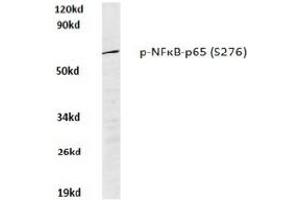 Image no. 1 for anti-Nuclear Factor-kB p65 (NFkBP65) (pSer276) antibody (ABIN318082) (NF-kB p65 antibody  (pSer276))