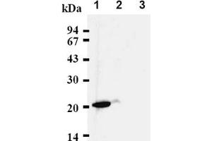 Western Blotting (WB) image for anti-Cyclin-Dependent Kinase Inhibitor 1A (p21, Cip1) (CDKN1A) antibody (ABIN487485)