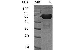 Western Blotting (WB) image for Coxsackie Virus and Adenovirus Receptor (CXADR) protein (Fc Tag) (ABIN7320841) (Coxsackie Adenovirus Receptor Protein (Fc Tag))