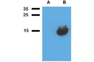 Western blot analysis of polyclonal anti-Mycobacterium tuberculosis antigen Acr1. (HspX antibody)