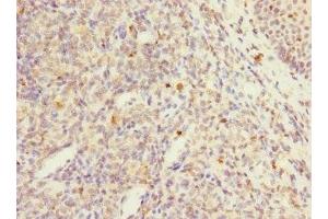 Immunohistochemistry of paraffin-embedded human tonsil tissue using ABIN7174120 at dilution of 1:100 (PTPN7 antibody  (AA 1-190))