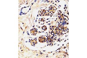 Antibody staining LALBA in Human breast tissue sections by Immunohistochemistry (IHC-P - paraformaldehyde-fixed, paraffin-embedded sections). (LALBA antibody  (AA 39-68))