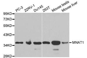 Western blot analysis of extracts of various cell lines, using MNAT1 antibody. (MNAT1 antibody  (AA 1-309))