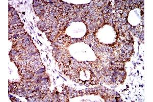 Immunohistochemistry (IHC) image for anti-Superoxide Dismutase 2, Mitochondrial (SOD2) (AA 1-222) antibody (ABIN5888812) (SOD2 antibody  (AA 1-222))