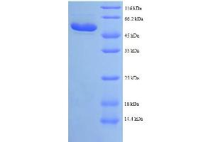 Hydroxyacyl-CoA Dehydrogenase/3-Ketoacyl-CoA Thiolase/enoyl-CoA Hydratase (Trifunctional Protein), beta Subunit (HADHB) (AA 35-283), (partial) protein (GST tag) (HADHB Protein (AA 35-283, partial) (GST tag))