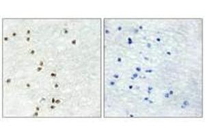 Immunohistochemistry analysis of paraffin-embedded human brain tissue using ZIC1/2/3 antibody. (ZIC1 antibody)