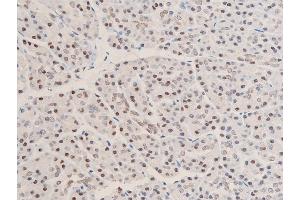 ABIN6267073 at 1/100 staining human duodenum tissue sections by IHC-P. (CHEK1 antibody  (pSer280))