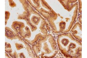 IHC image of ABIN7139704 diluted at 1:100 and staining in paraffin-embedded human prostate tissue performed on a Leica BondTM system. (PSMD6 antibody  (Regulatory Subunit 6))
