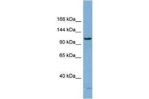 WB Suggested Anti-DHX15 Antibody Titration:  0. (DHX15 antibody  (N-Term))