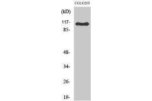 Western Blotting (WB) image for anti-RhoGEF p115 (Internal Region) antibody (ABIN3177221) (RhoGEF p115 (Internal Region) antibody)