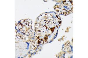 Immunohistochemistry of paraffin-embedded human placenta using Fibrinogen alpha chain (FGA) (FGA) Rabbit mAb (ABIN7267177) at dilution of 1:100 (40x lens). (FGA antibody)