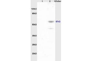 Lane 1: mouse brain lysates Lane 2: mouse lung lysates probed with Anti Phospho-Lyn (Tyr507) Polyclonal Antibody, Unconjugated (ABIN743603) at 1:200 in 4 °C. (LYN antibody  (pTyr508))