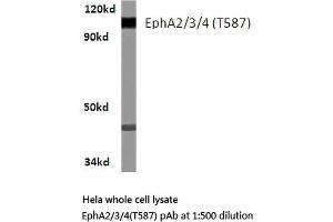 Western blot (WB) analysis of EphA2/3/4 antibody in extracts from Hela cells.