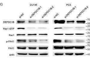 DEPDC1B regulates the Rho signaling pathway and binds to Rac1. (PAK1 antibody  (AA 1-240))