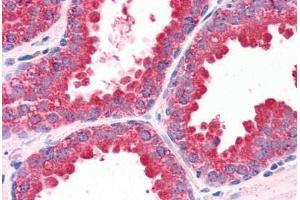 Human Prostate (formalin-fixed, paraffin-embedded) stained with DUSP1 antibody ABIN351458 at 3. (DUSP1 antibody  (AA 355-367))