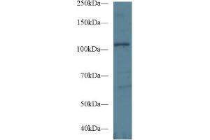 Western Blot; Sample: Human Hela cell lysate; Primary Ab: 1µg/ml Rabbit Anti-Mouse EPHA1 Antibody Second Ab: 0. (EPHA1 antibody  (AA 716-960))