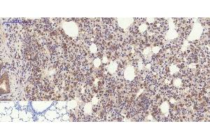 Immunohistochemistry of paraffin-embedded Rat lung tissue using YAP1 Polyclonal Antibody at dilution of 1:200. (YAP1 antibody)