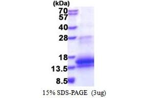 SDS-PAGE (SDS) image for WAP Four-Disulfide Core Domain 12 (WFDC12) (AA 24-111) protein (His tag) (ABIN5853474)