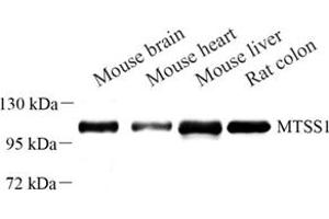 Western blot analysis of MTSS1 (ABIN7074604) at dilution of 1: 500 (MTSS1 antibody)