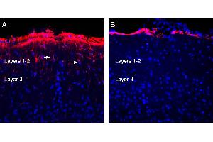 Expression of GFAP in rat parietal cortex.