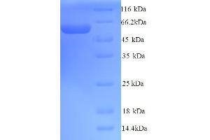SDS-PAGE (SDS) image for Preferentially Expressed Antigen in Melanoma (PRAME) (AA 1-509), (full length) protein (His tag) (ABIN5713748)