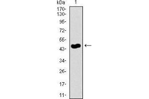 Western Blotting (WB) image for anti-Guanylate Cyclase 1 Soluble Subunit Alpha (GUCY1A1) (AA 22-214) antibody (ABIN1724788)