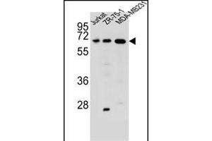 ZSCAN2 Antibody (N-term) (ABIN657010 and ABIN2846190) western blot analysis in Jurkat,ZR-75-1,MDA-M cell line lysates (35 μg/lane).