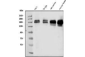 Western blot analysis of KDM5B using anti-KDM5B antibody (ABIN4886648). (KDM5B antibody  (Middle Region))