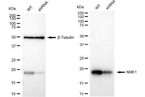 Western blotting analysis using NME1 antibody (ABIN7799617).