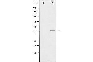 Western blot analysis of CCR5 phosphorylation expression in Jurkat whole cell lysates,The lane on the left is treated with the antigen-specific peptide.