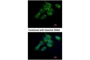 ICC/IF Image Immunofluorescence analysis of methanol-fixed Hep3B, using HSD17B4, antibody at 1:500 dilution. (HSD17B4 antibody)