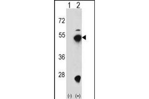 Western blot analysis of FDPS (arrow) using rabbit polyclonal FDPS Antibody (D31) (ABIN1882080 and ABIN2839262).