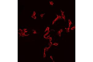 ABIN6269118 staining 293 by IF/ICC. (IGF1R antibody  (C-Term))