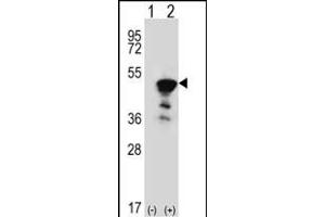 Western blot analysis of FEN1 (arrow) using rabbit polyclonal FEN1 Antibody (Center) (ABIN389376 and ABIN2839472).