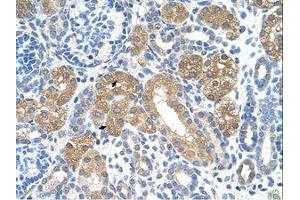 Image no. 1 for anti-Fumarylacetoacetate Hydrolase (Fumarylacetoacetase) (FAH) (AA 311-360) antibody (ABIN320667) (FAH antibody  (AA 311-360))