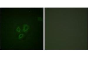 Immunofluorescence analysis of HepG2 cells, using TNNI3 (Ab-22/23) Antibody. (TNNI3 antibody  (AA 5-54))