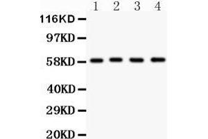 Anti- G6PD antibody, Western blotting All lanes: Anti G6PD  at 0. (Glucose-6-Phosphate Dehydrogenase antibody  (AA 315-515))