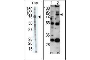 Image no. 1 for anti-Matrix Metallopeptidase 9 (Gelatinase B, 92kDa Gelatinase, 92kDa Type IV Collagenase) (MMP9) (C-Term) antibody (ABIN358703) (MMP 9 antibody  (C-Term))