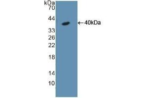 Detection of Recombinant KRT18, Rat using Polyclonal Antibody to Cytokeratin 18 (CK18) (Cytokeratin 18 antibody  (AA 72-380))