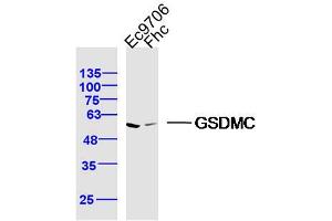Lane 1: Ec9706 lysates Lane 2: FHC lysates probed with GSDMC Polyclonal Antibody, Unconjugated  at 1:300 dilution and 4˚C overnight incubation. (MLZE antibody  (AA 1-100))
