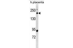 BCL9L antibody  (N-Term)