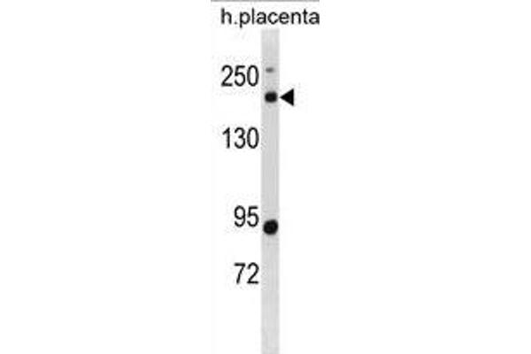 BCL9L antibody  (N-Term)