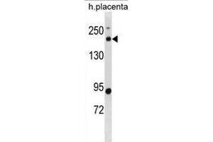 BCL9L Antibody (N-term) (ABIN1881110 and ABIN2838843) western blot analysis in human placenta tissue lysates (35 μg/lane). (BCL9L antibody  (N-Term))