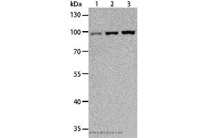 Western blot analysis of Hela, Raji and K562 cell, using TLR3 Polyclonal Antibody at dilution of 1:500 (TLR3 antibody)