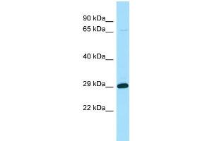 WB Suggested Anti-STARD6 Antibody Titration: 1. (STARD6 antibody  (N-Term))