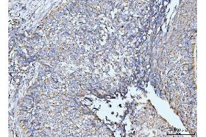 IHC analysis of GRPEL1 using anti-GRPEL1 antibody (ABIN7602643). (GRPEL1 antibody  (AA 90-217))