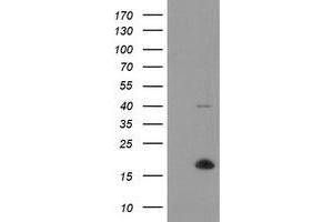 HEK293T cells were transfected with the pCMV6-ENTRY control (Left lane) or pCMV6-ENTRY TPD52L3 (Right lane) cDNA for 48 hrs and lysed. (TPD52L3 antibody)