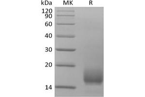 Western Blotting (WB) image for CD59 (CD59) protein (His tag) (ABIN7319910) (CD59 Protein (CD59) (His tag))