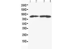 Anti-MTA1 antibody, Western blotting Lane 1: MCF-7 Cell Lysate Lane 2: HELA Cell Lysate Lane 3: JURKAT Cell Lysate Lane 4: CEM Cell Lysate (MTA1 antibody  (C-Term))