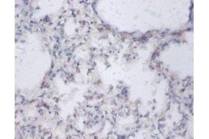 IHC analysis of paraffin-embedded human lung tissue using Diamine acetyltransferase 1 Antibody (1/100 dilution). (SAT1 antibody  (AA 5-171))